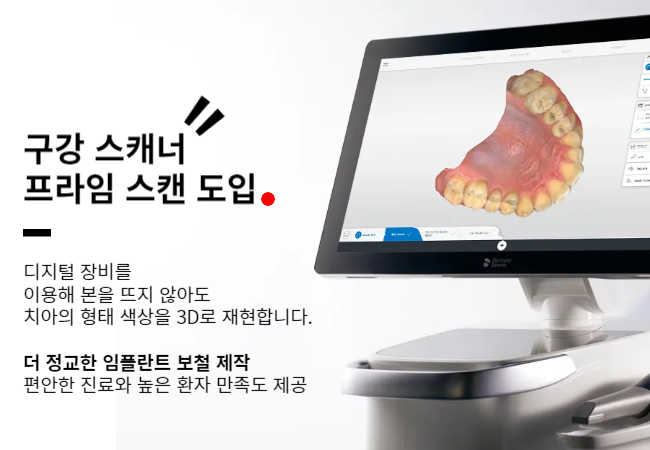 디지털 스캐너